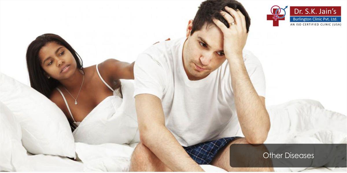 Treatment to Male Sexual Problems